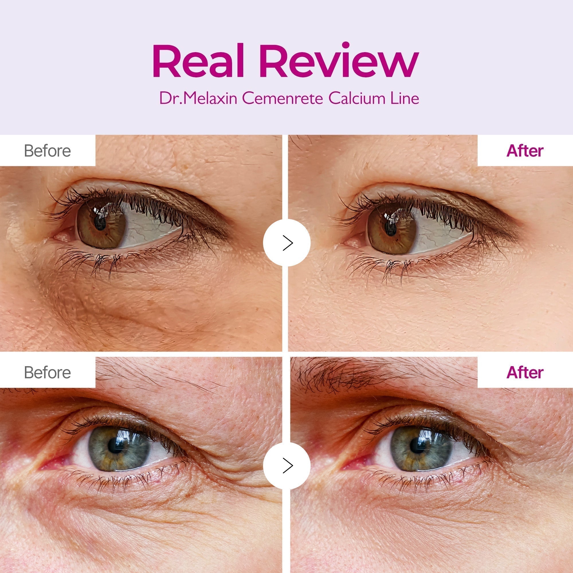Cemenrete Calcium Volume Augenpflaster 60 Stk.