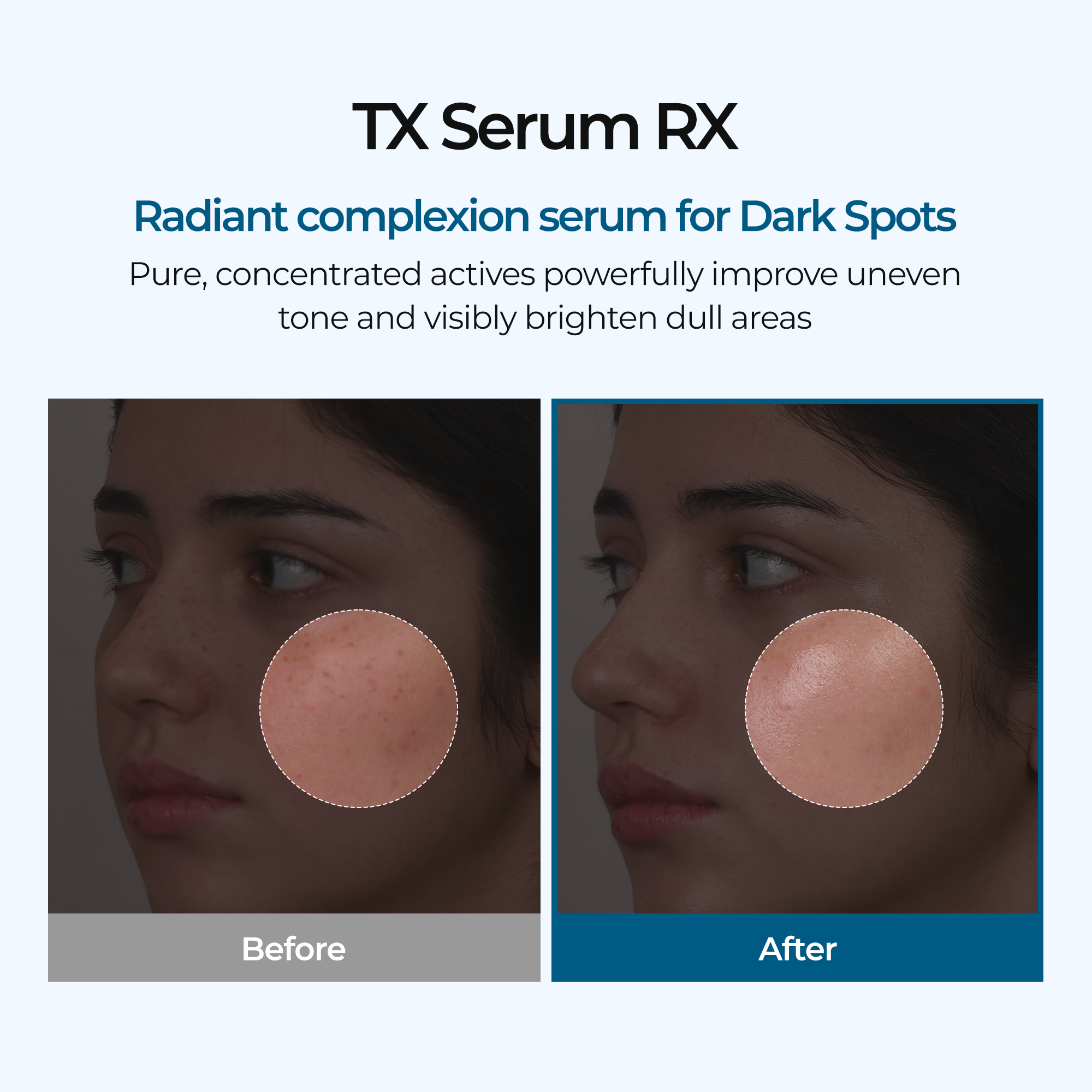 TX Ampulle Rx