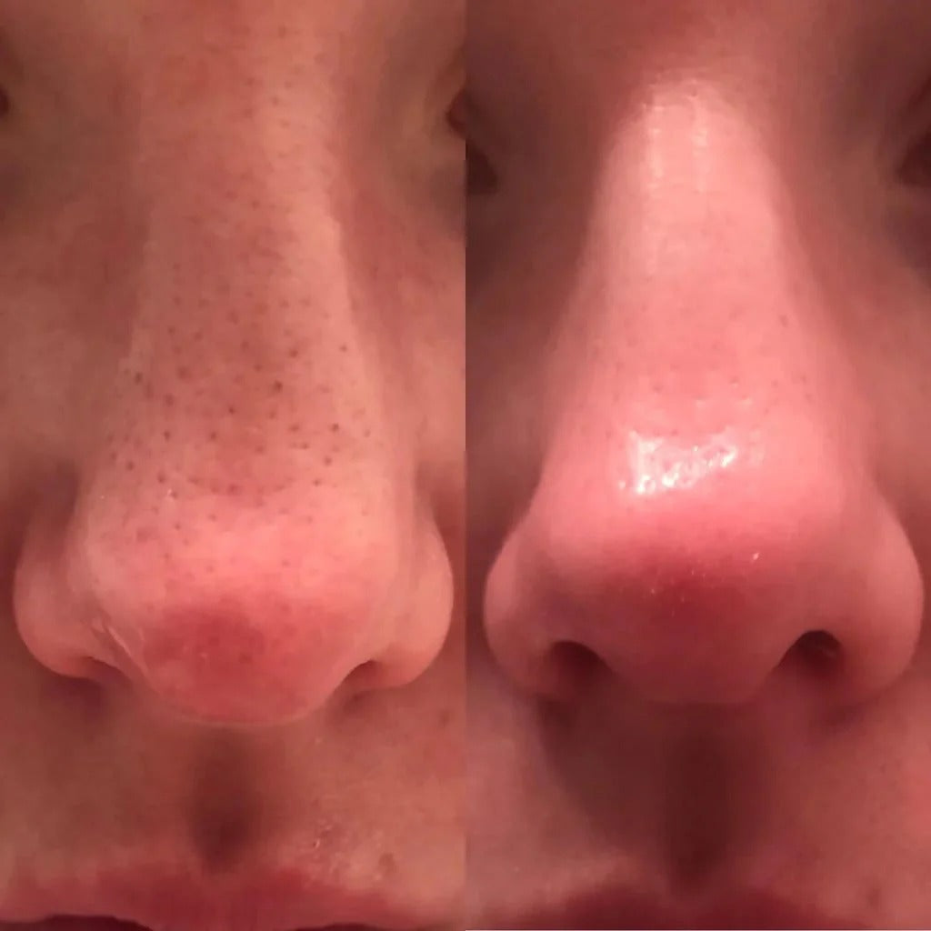 Glass Skin Essential Kit (5-teilig)