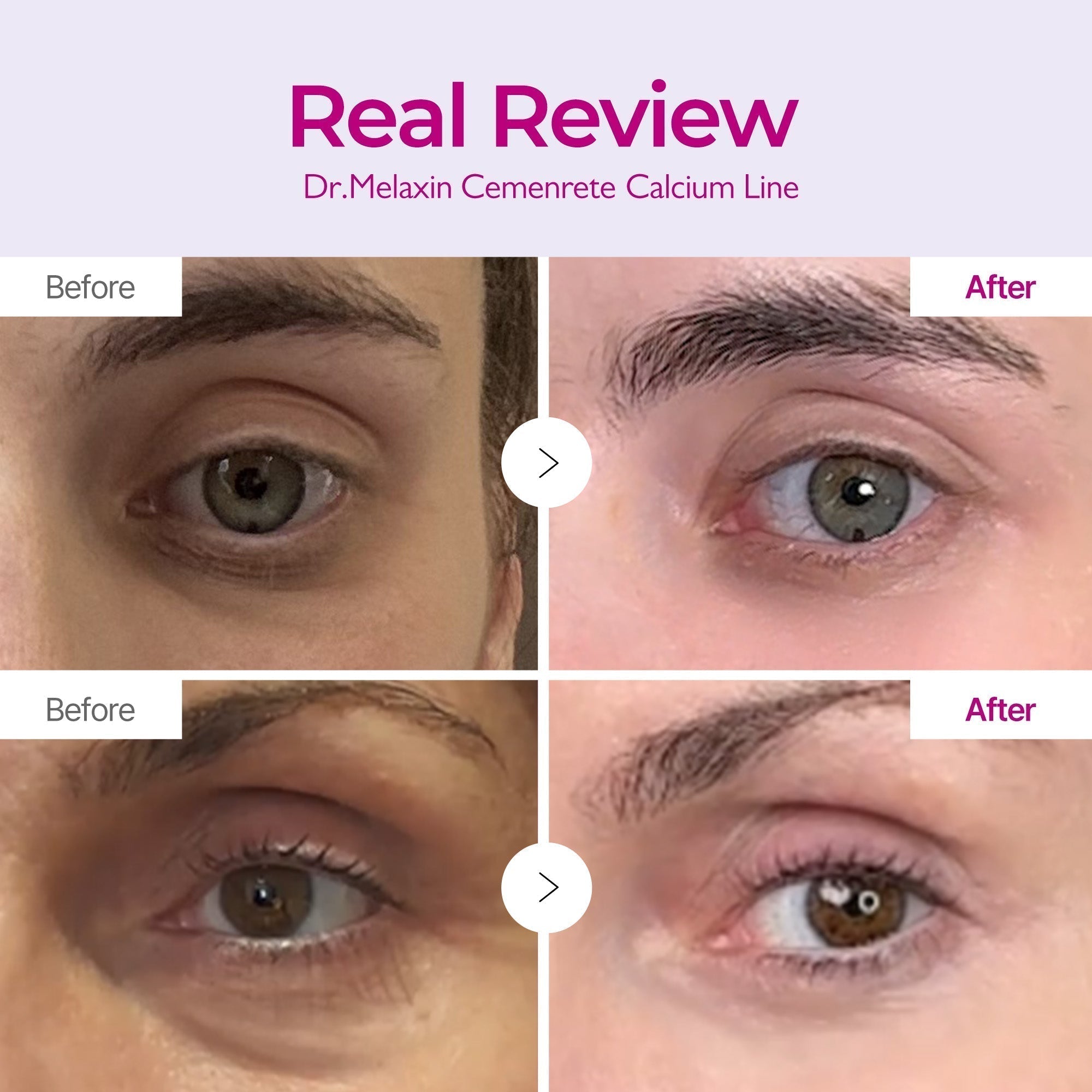 Cemenrete Calcium Augenpflege-Routine