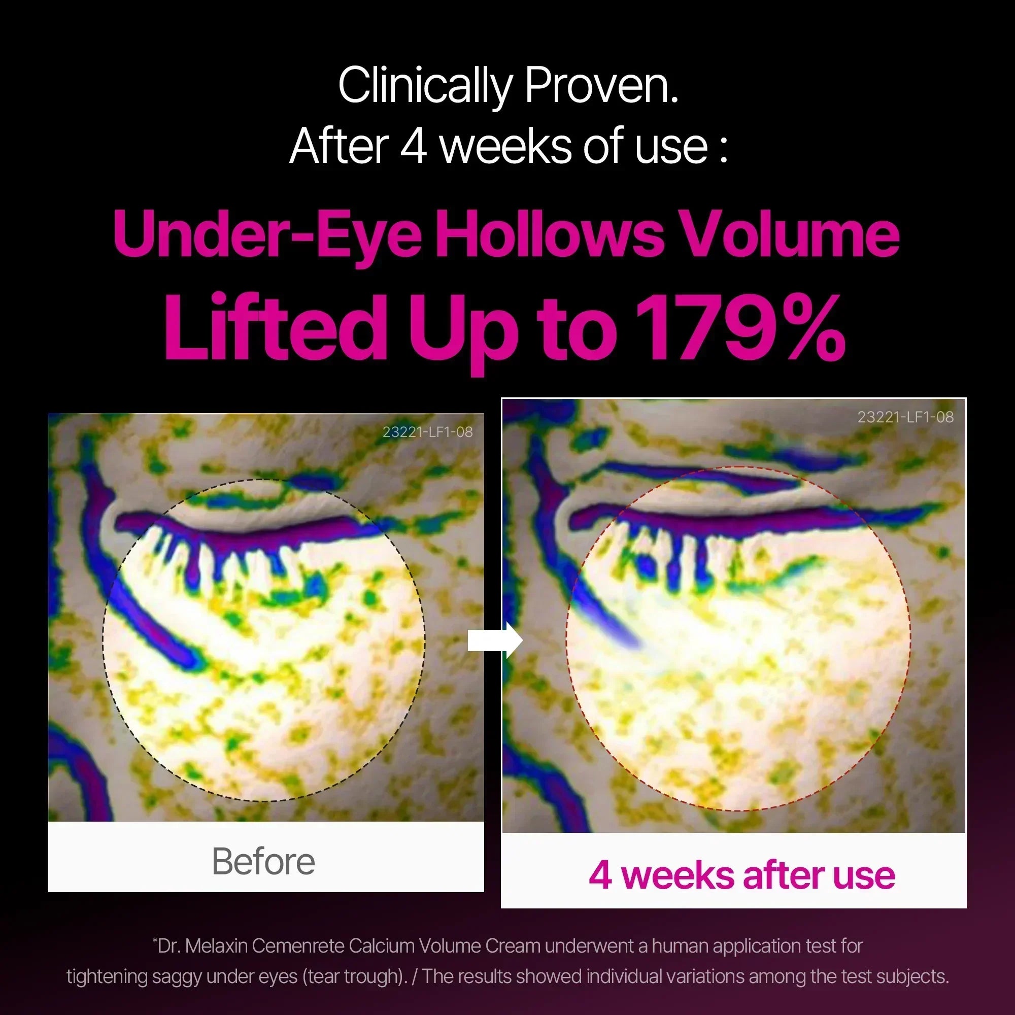 Cemenrete Calcium Intensiv Creme