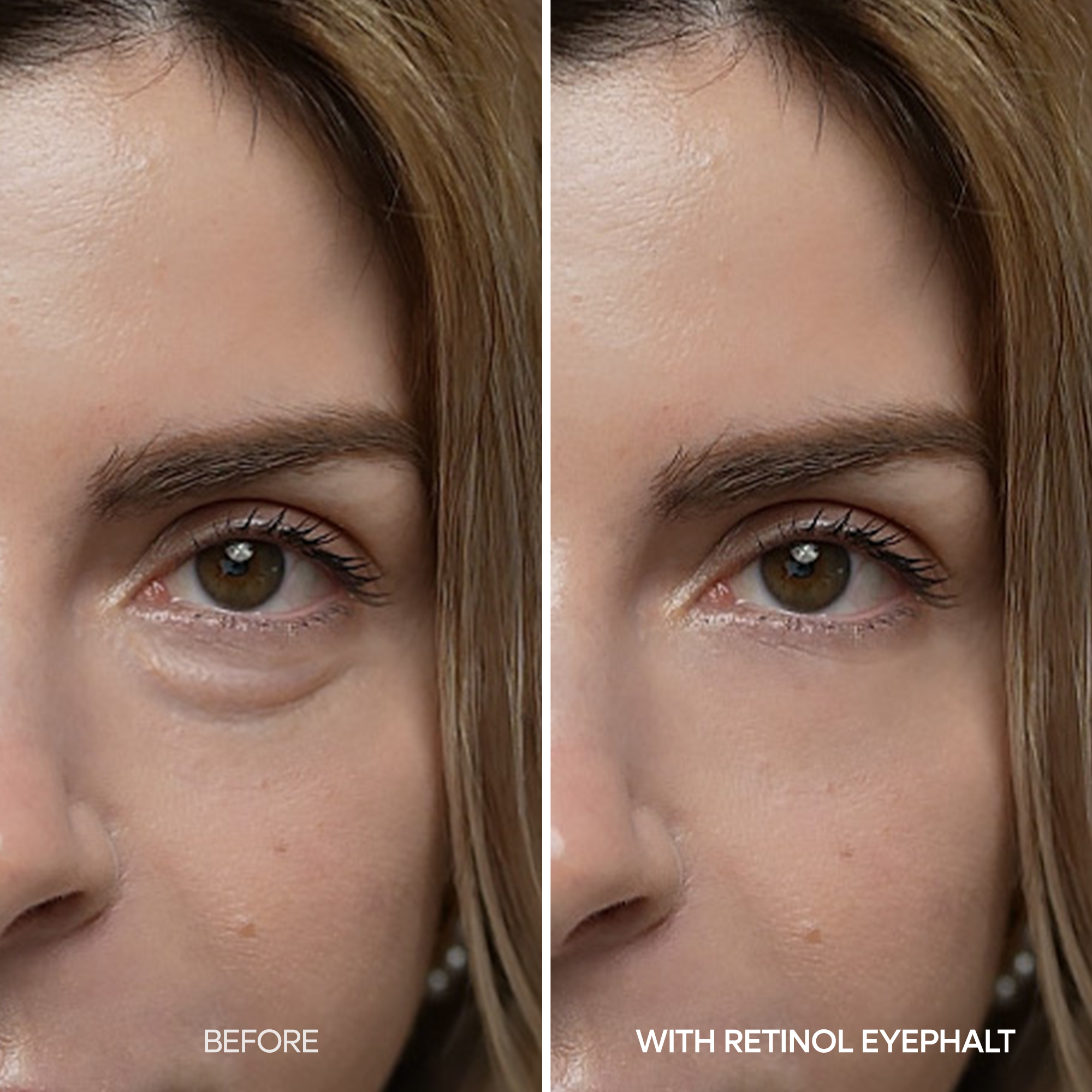 [FLASH 1+1 DEAL] Retinol-Augencreme gegen Tränensäcke
