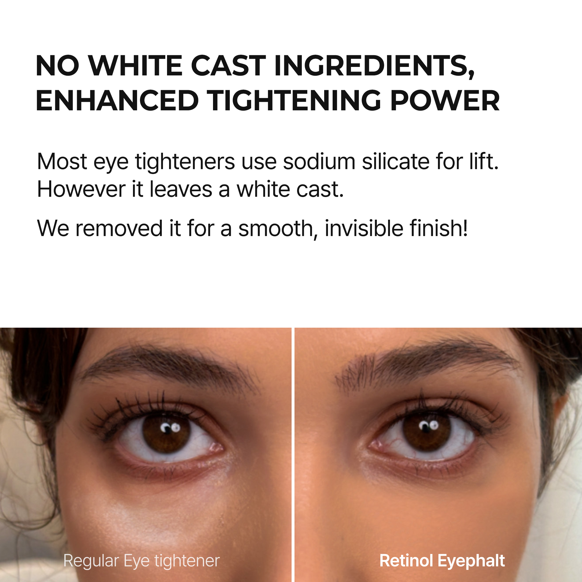 [FLASH 1+1 DEAL] Retinol-Augencreme gegen Tränensäcke