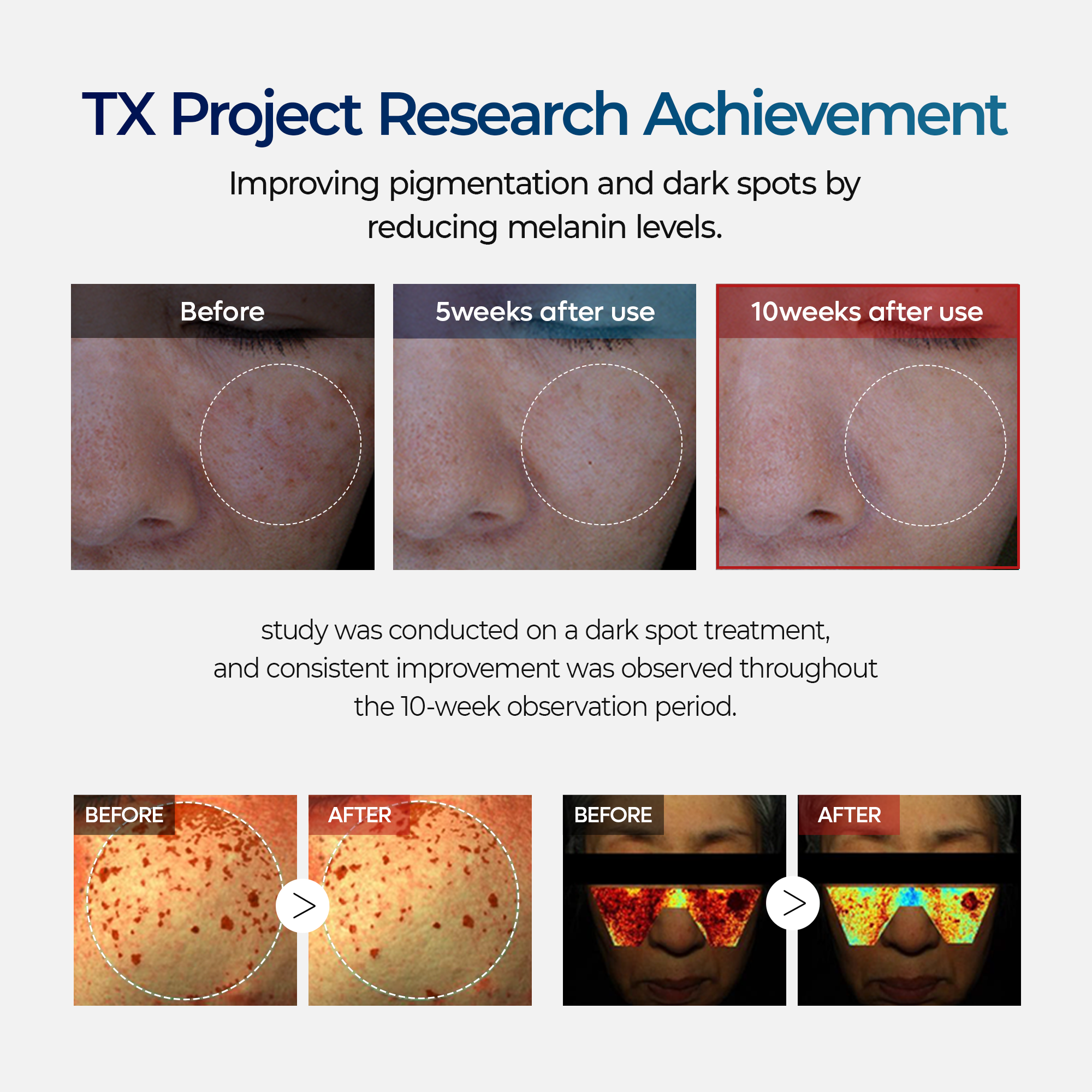 TX Ampulle Rx