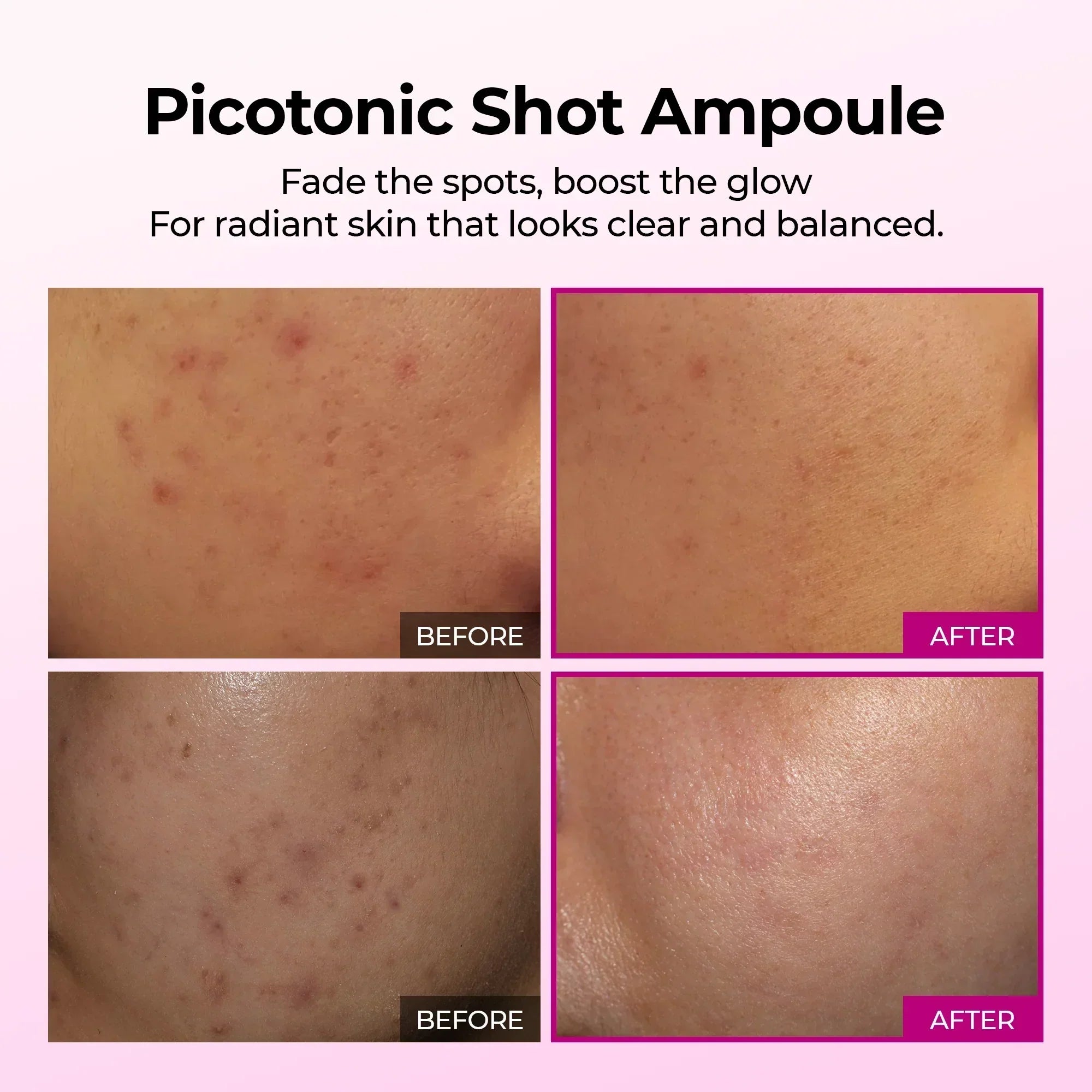 Picotonic Shot Pigmentierungsampulle
