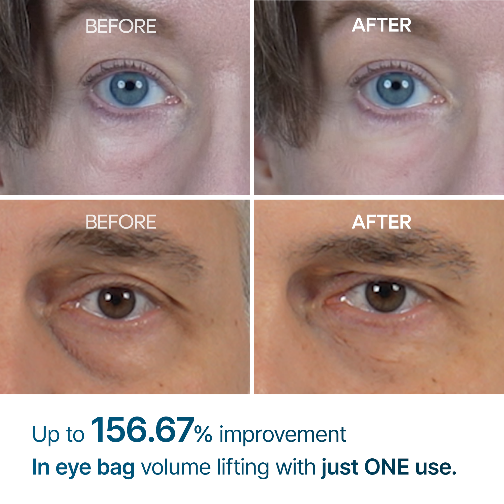 [SONDERANGEBOT 1+1] Eyephalt Augencreme gegen Tränensäcke