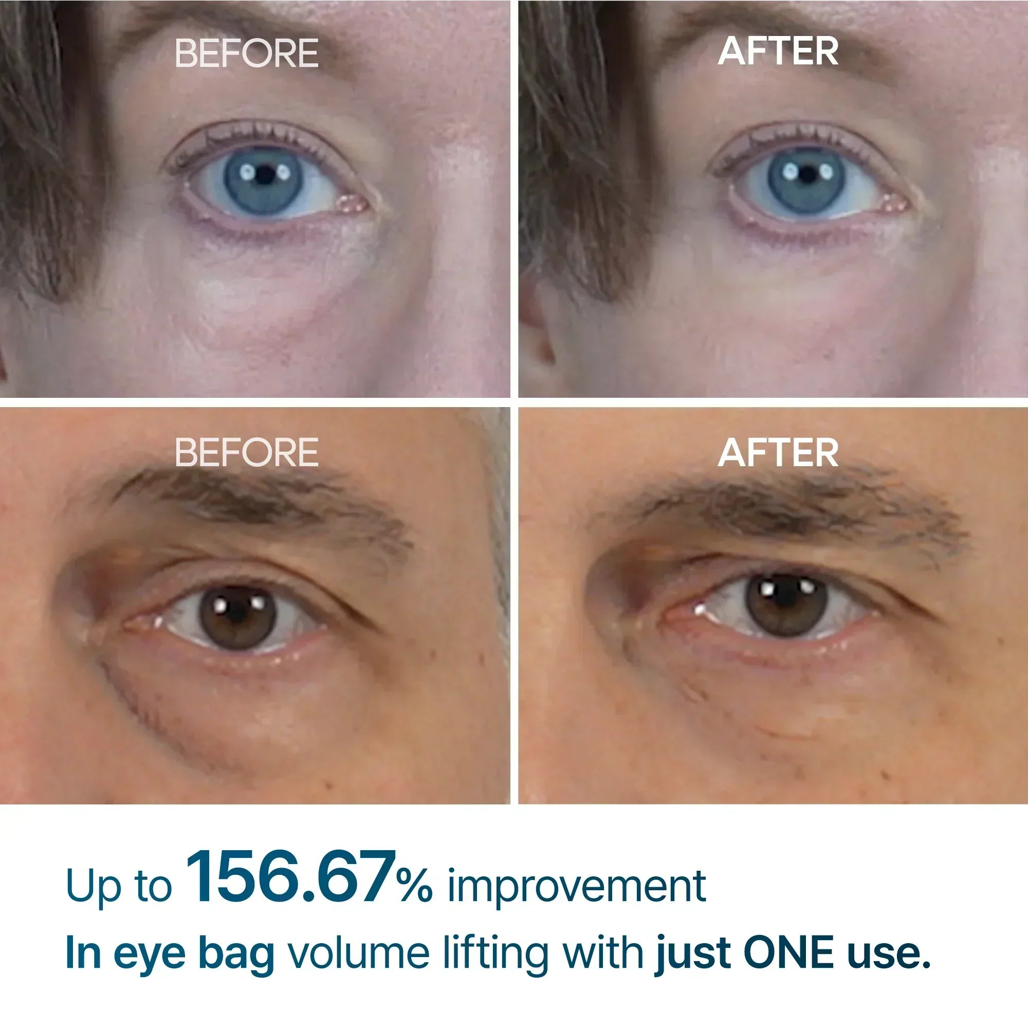 Eyephalt Augenlidcreme