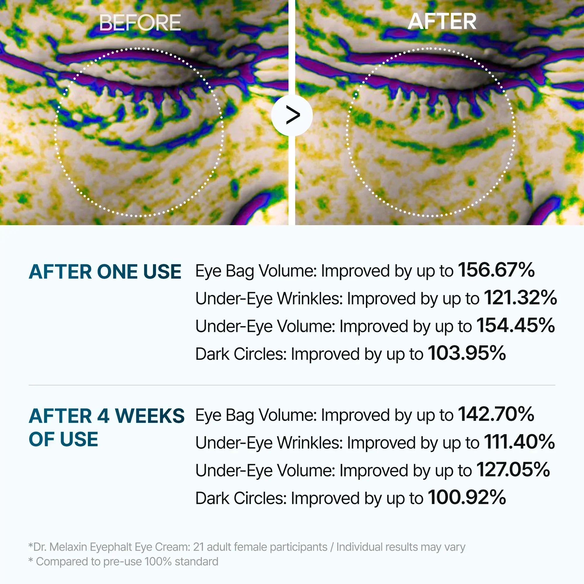 [Day&Night Care] Eyephalt Tränensack-Lifting-Linie