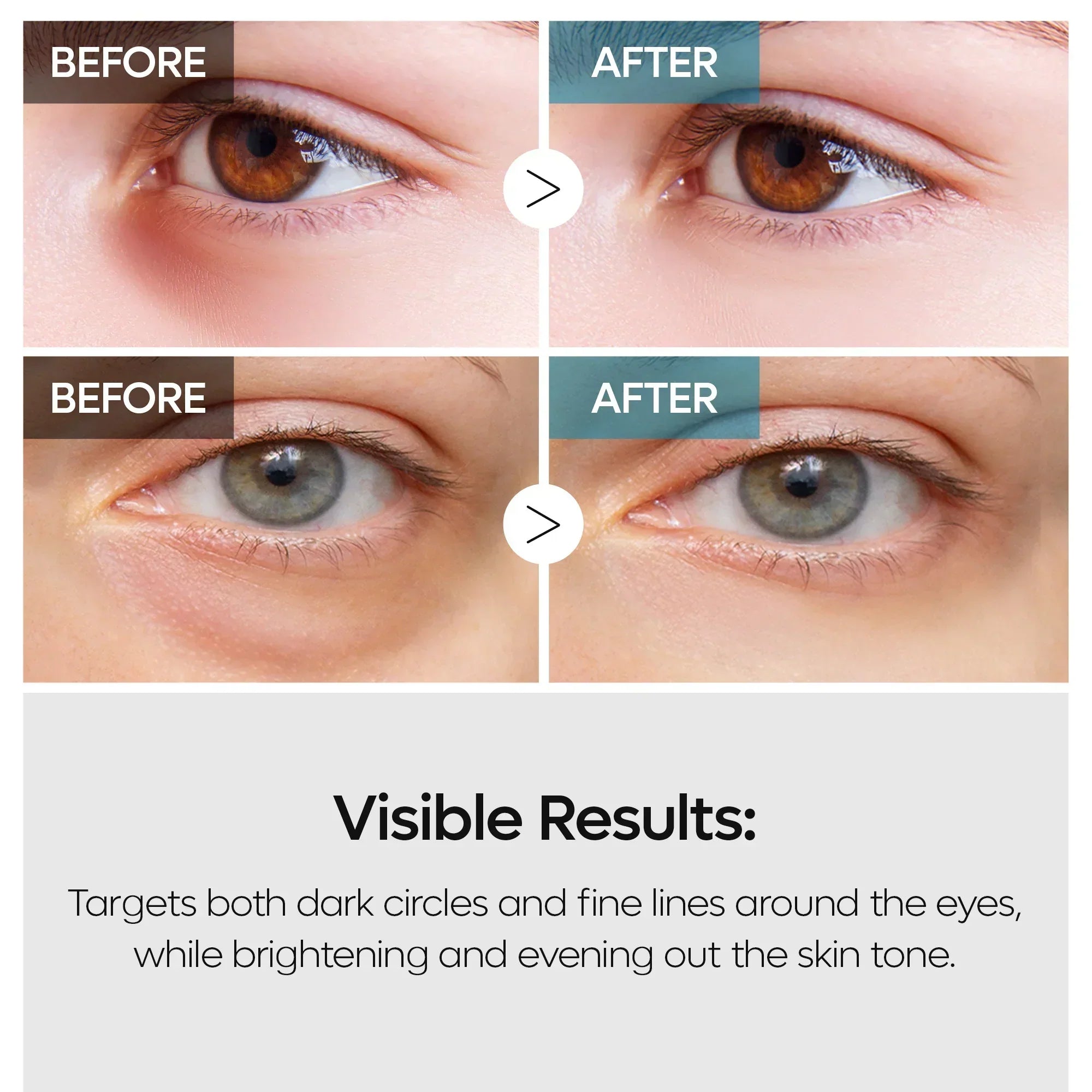 TX Retinalsom Doppeleffekt Augencreme