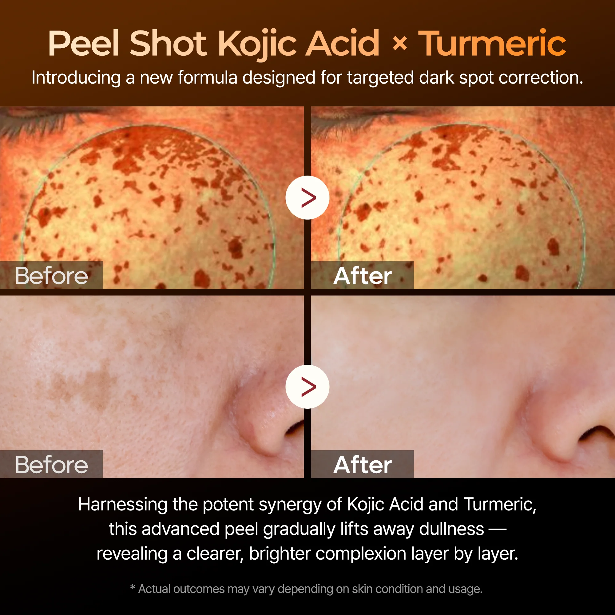 Peel Shot Kojisäure Kurkuma Serum